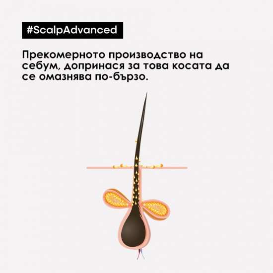Шампоан против мазен скалп Loreal Professionnel Anti-oiliness 300 ml